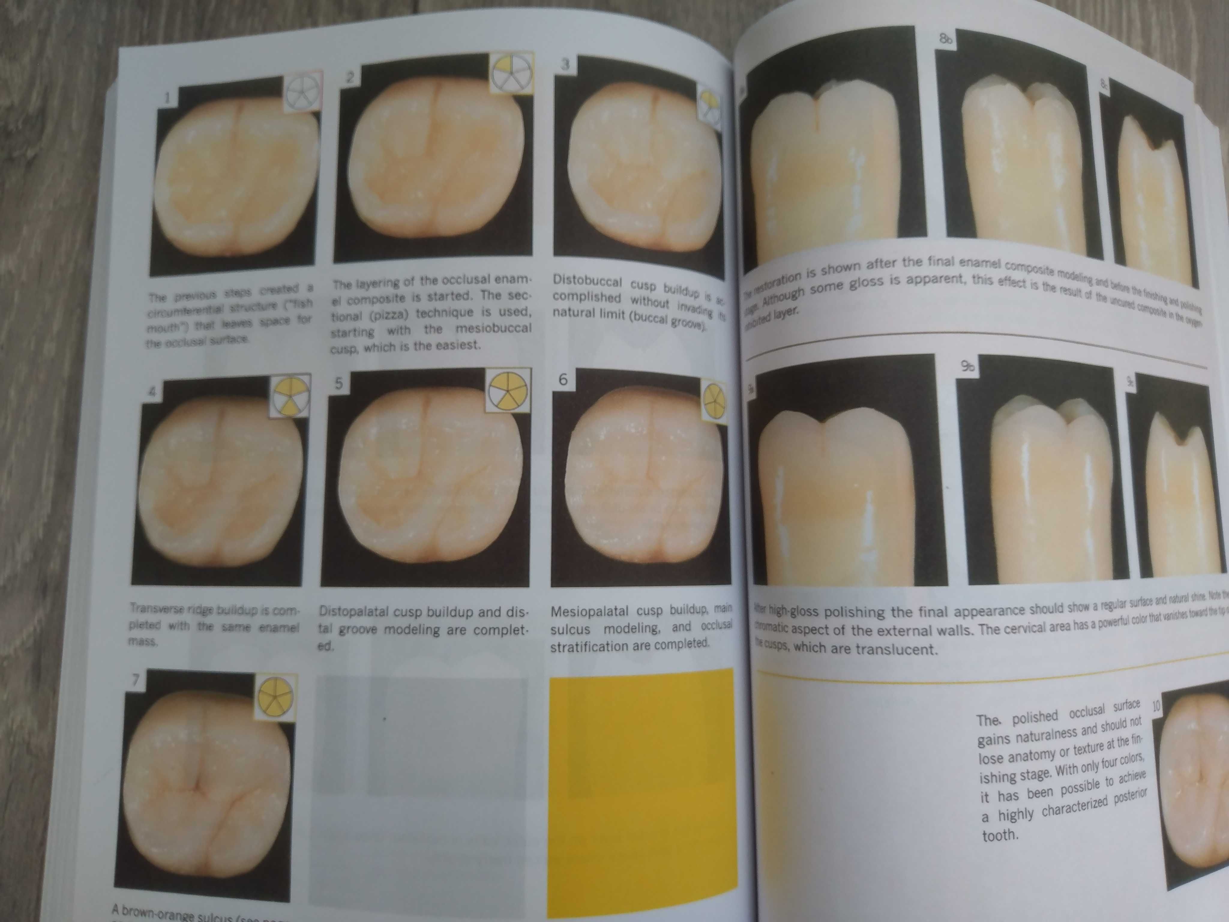 Layers: An Atlas of Composite Resin Stratification - 2012