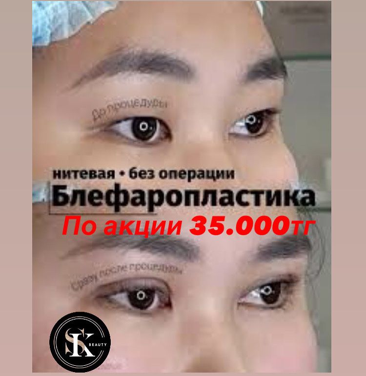 Броулифтинг по акции 80.000