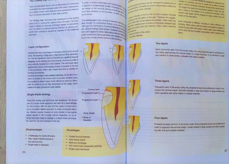Layers 2 Direct Composites: The Styleitaliano Clinical Secrets - 2022