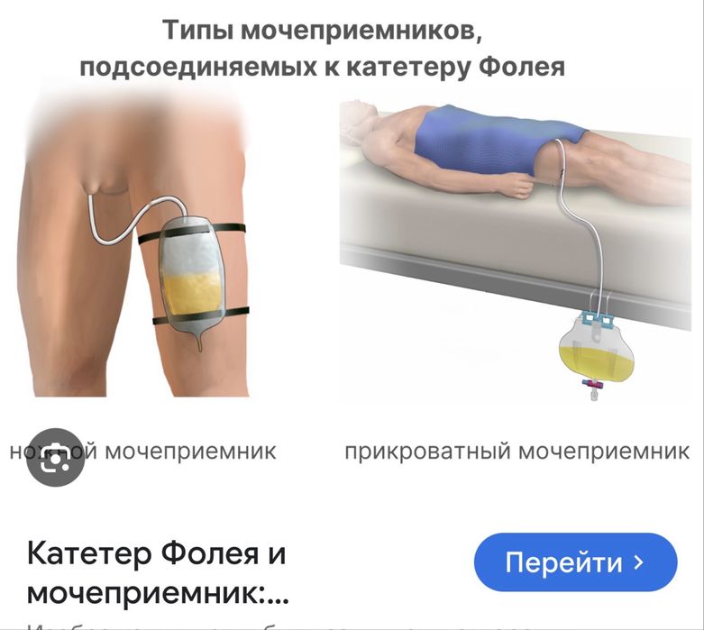 Установим центральный венозный катетер. Markaziy vena kateteri qo'yish