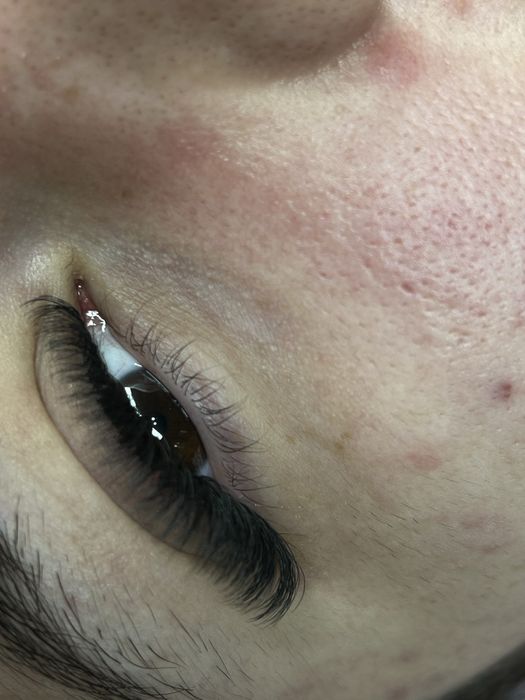 Aplic extensii de gene