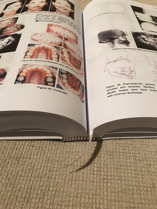 Goal-Directed ORTHOdontics 2013