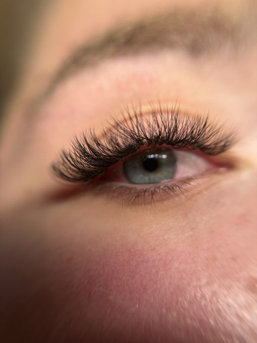 Промоция! Миглопластика и ламиниране