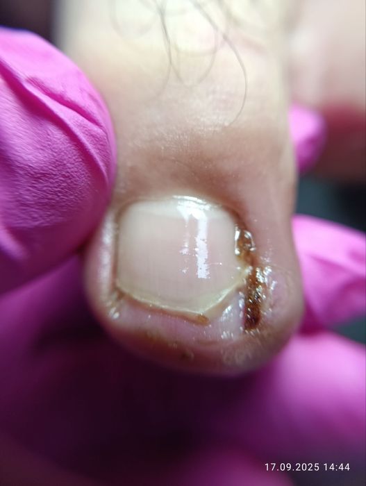 Подолог Сергели.