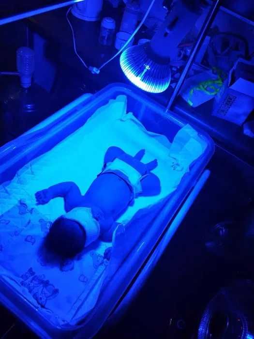 Светодиодная фотолампа для желтухи новорожденного
