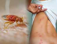 Dezinsectie Plosnite, Gandaci, Nebulizare, Servicii Profesionale