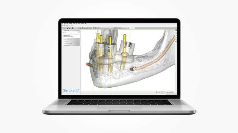 Exocad/ЗShape/Blender For Dental/BlueSkyPlan/Realgude/Invivo/Ezdent
