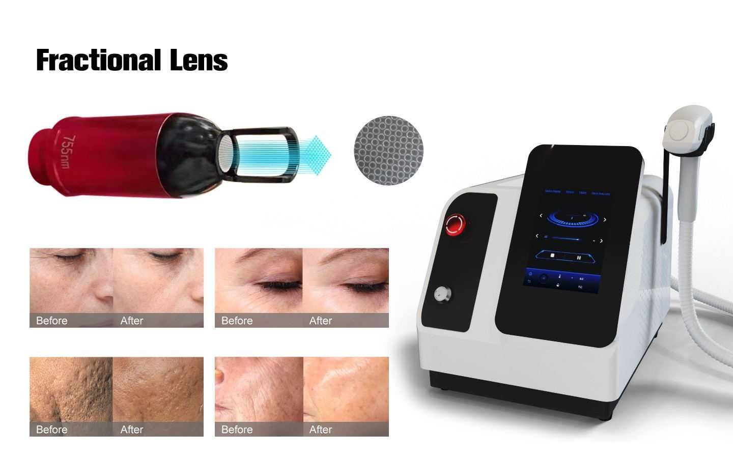 QL VII – Nd YAG Laser Machine