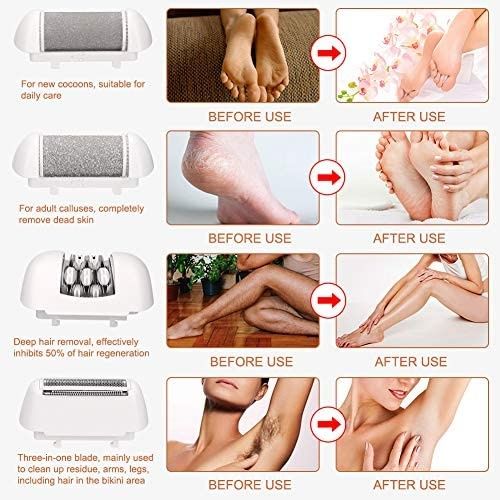 SET DE ÎNGRIJIRE HALOVIE 4 ÎN 1 - Pedichiura ȘI Epilare