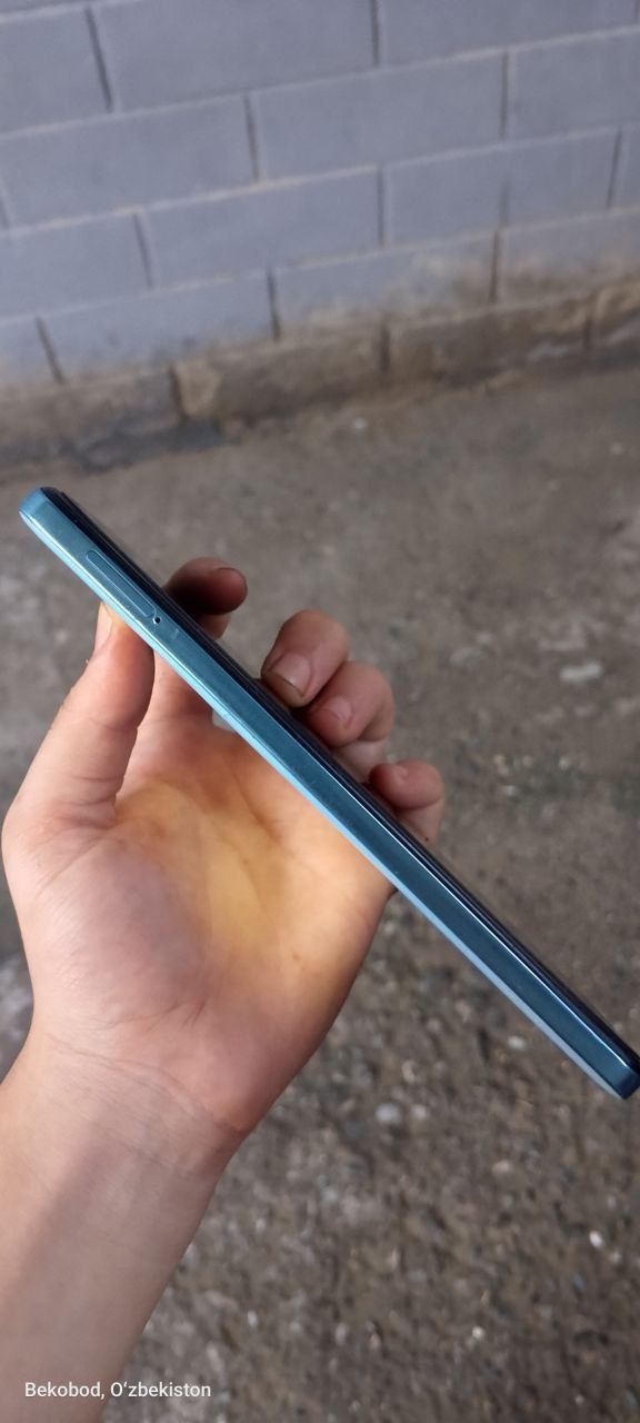 Redmi not 11 holati yaxshi