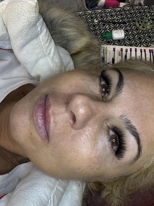 Aplic gene fir cu fir