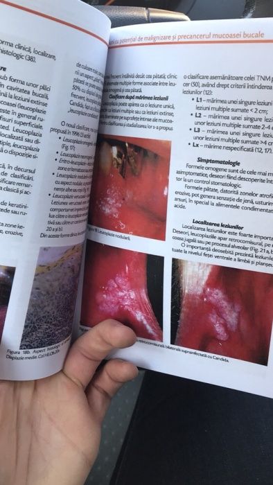 Medicina si patologie orala -TOVARU- Volumul II