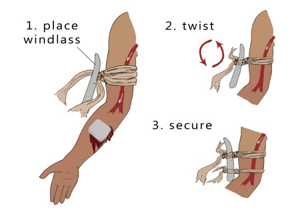 тактически турникет за първа помощ най бързото спиране на кръвозагуба