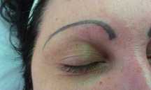 Scoatere tatuaj sprancene, eyeliner , buze. Tattoo removal