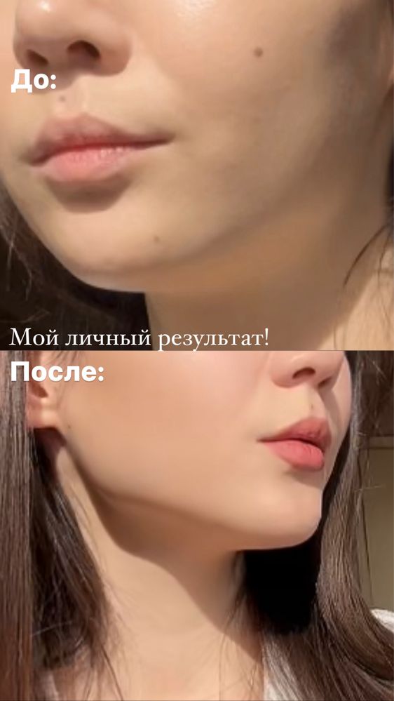 Бандаж для лица