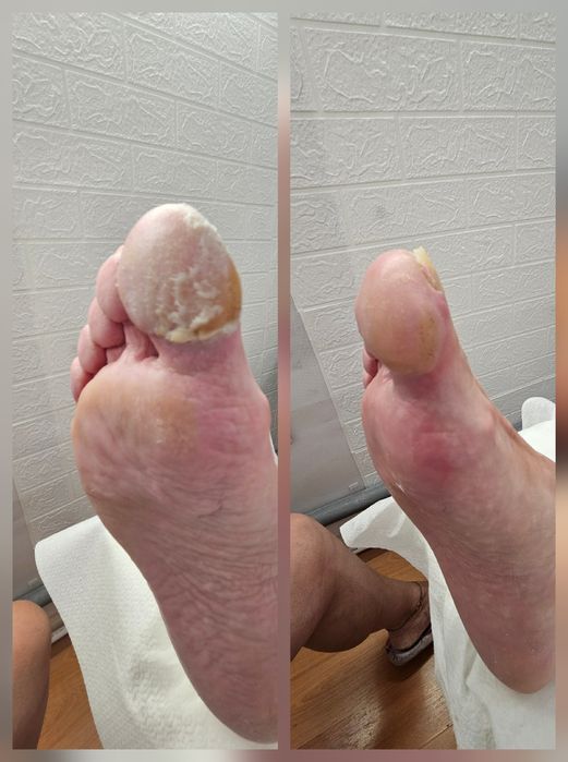 Pedichiură clasică Oradea