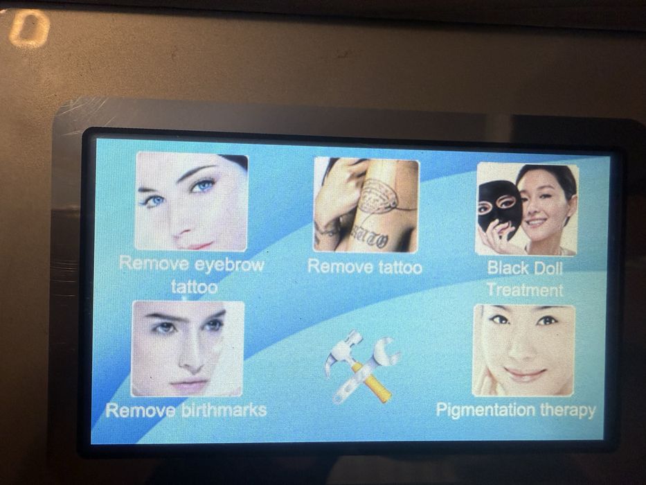 Laser indepartare tatuaje Q Switch ND YAG folosit