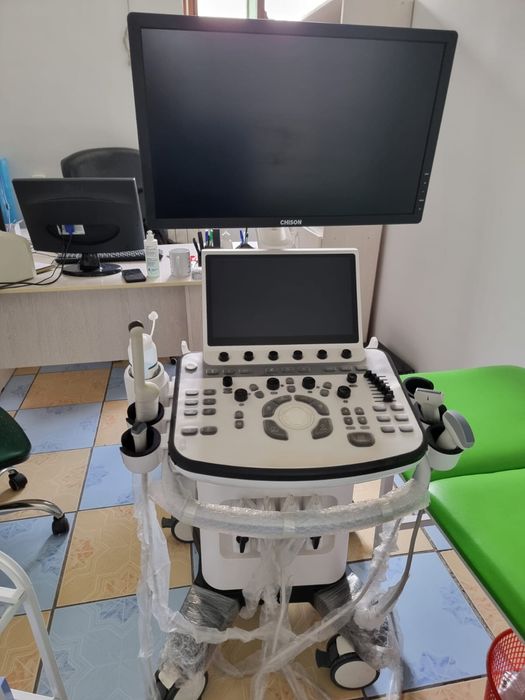 Узи аппарат Chison