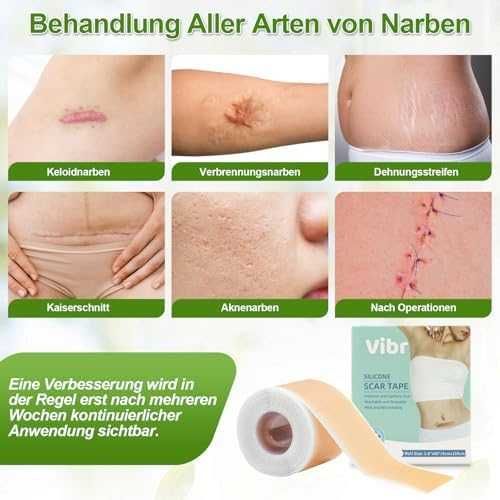 Нов Силиконов комплект за белези – лента и лепенки 4x15см, 4x150см