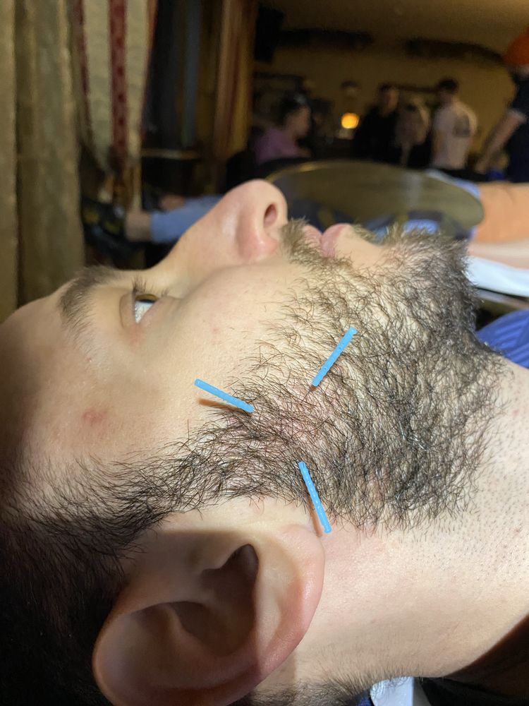 Kinetoterapie, Masaj, Chiropractică și Acupunctură (Dryneedling)