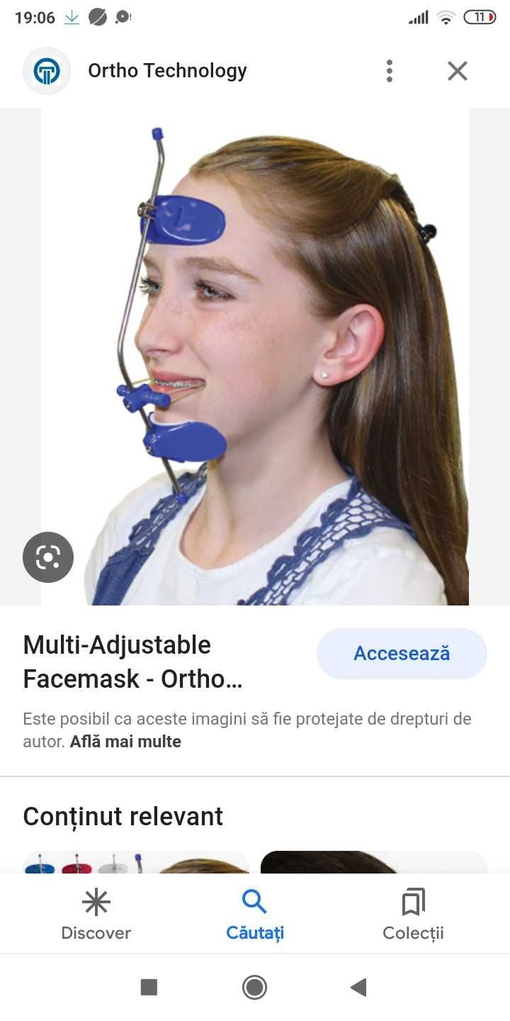 Masca Faciala Ortodontica clasa 3 tratament Ortho Texhnology USA