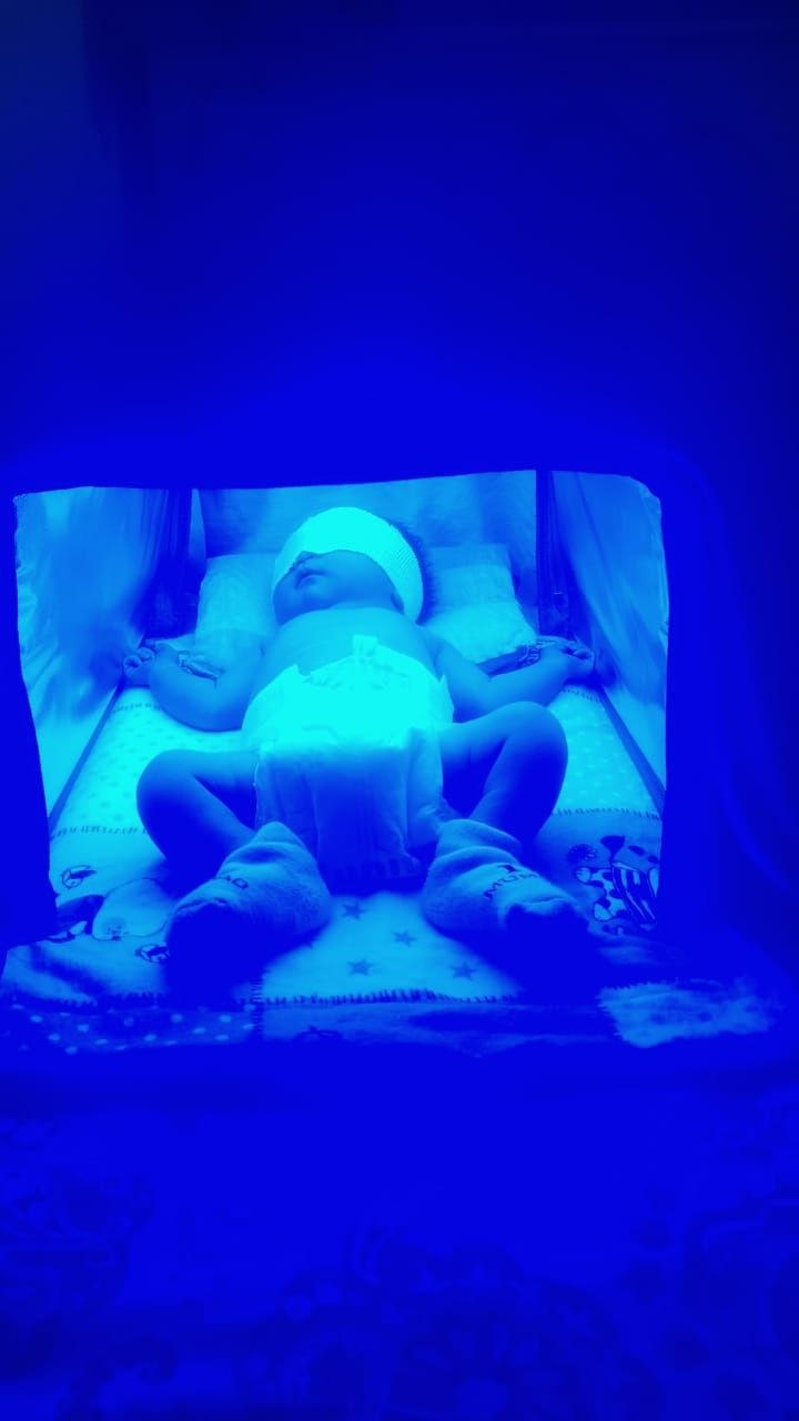 Фотолампа новорождённых