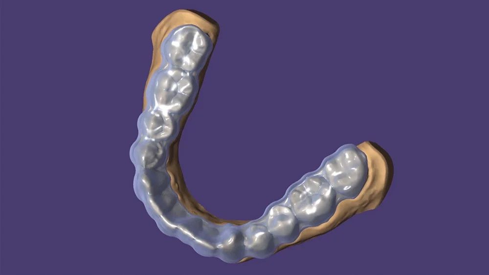 Exocad 3.2 elefsina  FULL / 3 shape