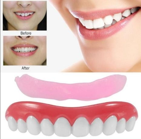 Fațete dentare universale - material silicon