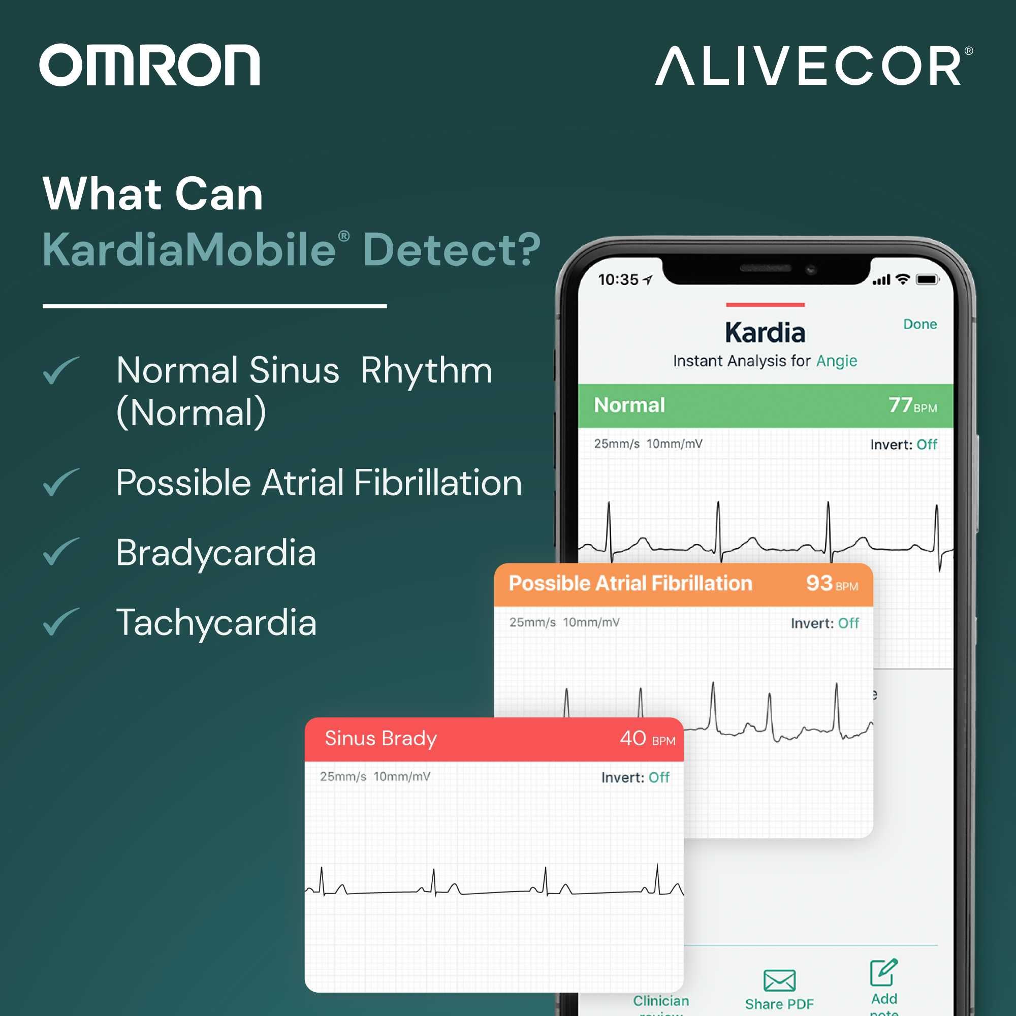 OMRON EKG/ЕКГ монитор електрокардиограма, сърдечен ритъм