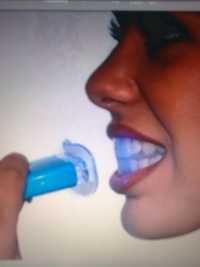 Уред за Професионално Лед избелване зъби.