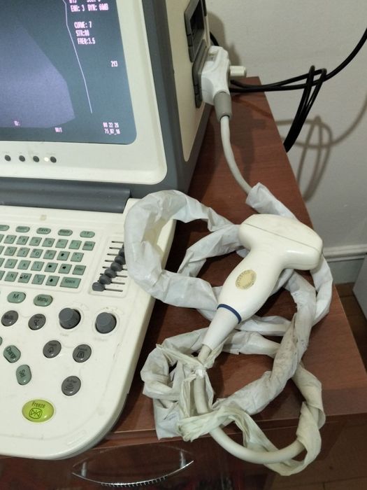 СРОЧНО продаётся КЛАССНЫЙ УЗИ АППАРАТ-портативный на низкую цену