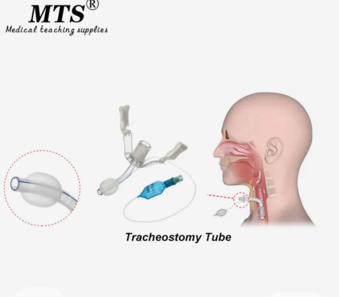 Трахеостомична обикновена тръба с балон