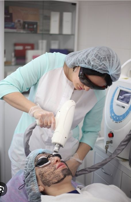 Карбоновый пилинг лица.