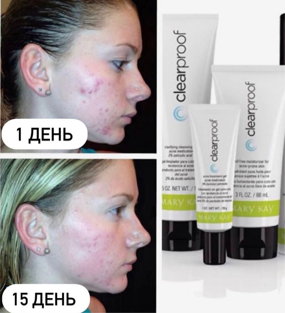 Увлажняющий крем от прыщей Mary Kay