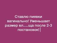 Продажа и постановка вагинально и на простату