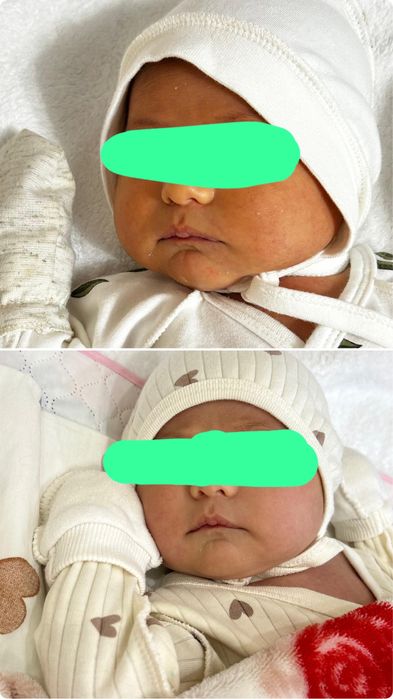 Фотолампа от желтушки, аренда фотолампы