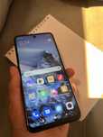 Redmi not 9pro ideal srochna 100% ishonchli