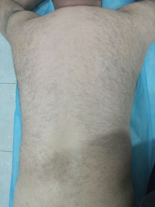 Депиляция мужская и женская