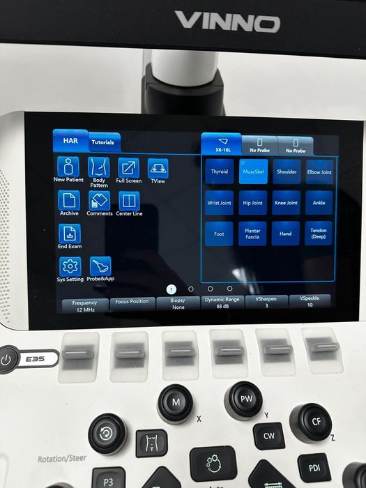 Vând sau închiriez ecograf ViNNO E35 – aproape nou,garanție valabilă