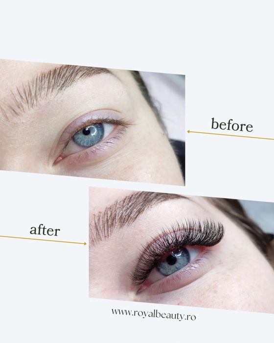 Gratuit- aplic extensii de gene