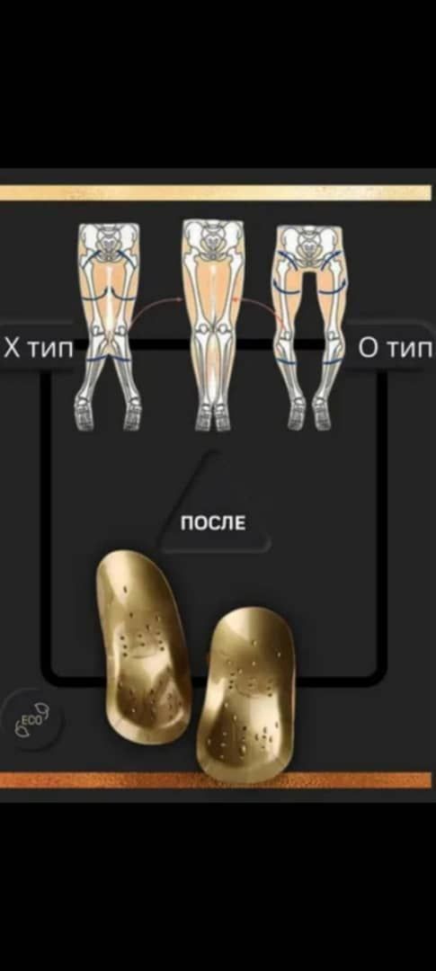 Коррекционные стельки,  ортопедические стельки с магнитами