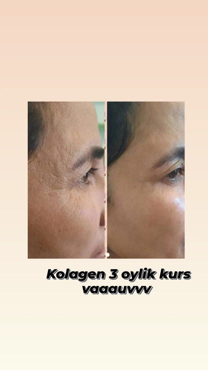 Collagen peptides chiroylik teri, mustahkam soch va tirnoqlar!