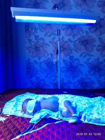 фотолампа от желтушки при гипербилирубинемии.Билитест