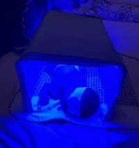 Фотолампа  от желтуши 800 т в сутки для новорожденного ребенка НО