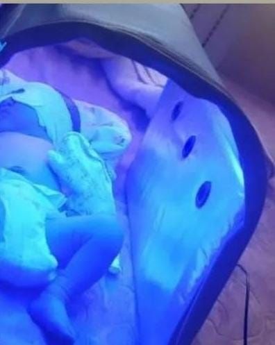 Фотолампа кювез билитест