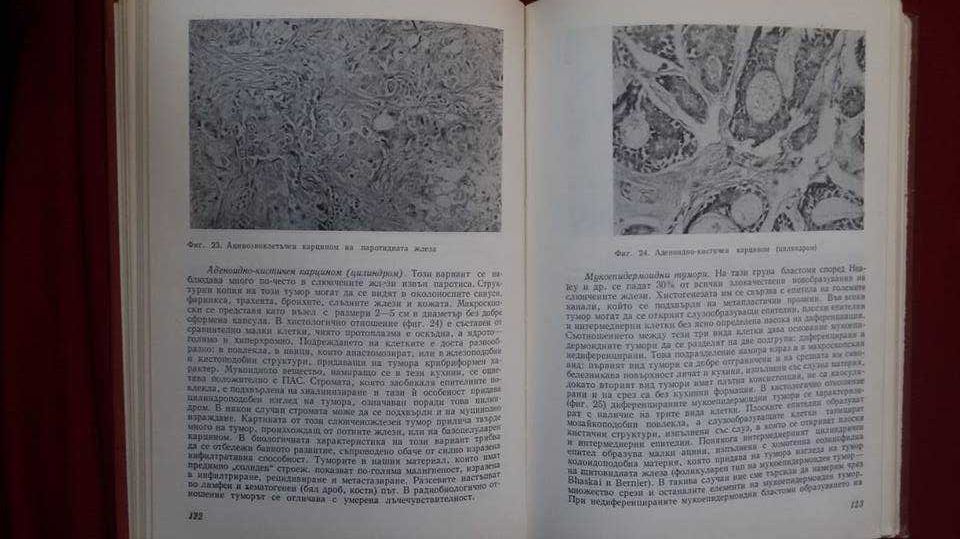 „Патология и биология на злокачествените тумори“ – проф.Райчо Райчев