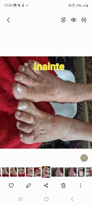 Manichiura și pedichiura profesională podologica la domiciliu