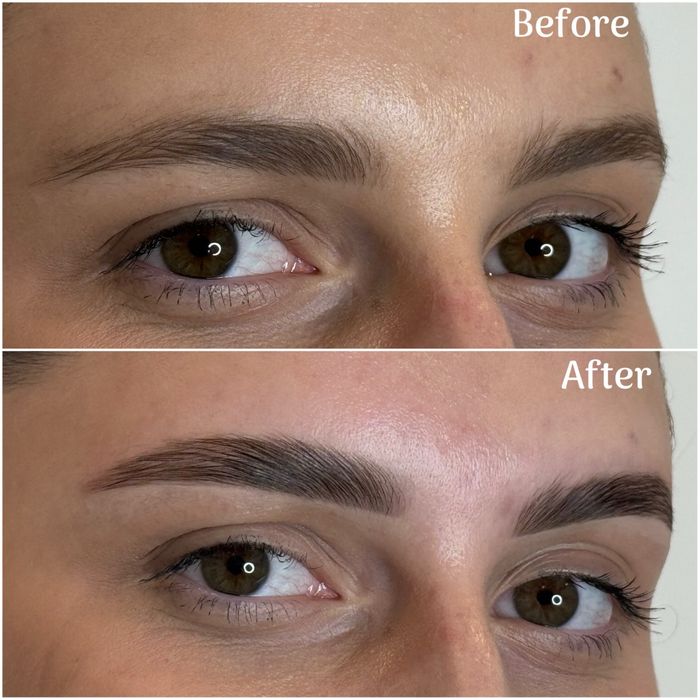 Laminare gene si sprancene