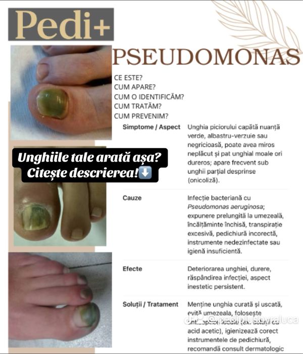 Pedichiura complexa si de infrumusetare Iasi