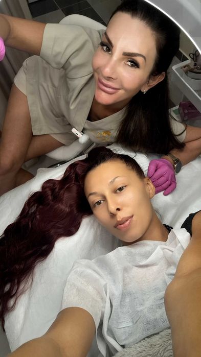 Терапии за лице и тяло, HIFU 7d,RF Микронидлинг,Лазер,Tecar Rf Пловдив